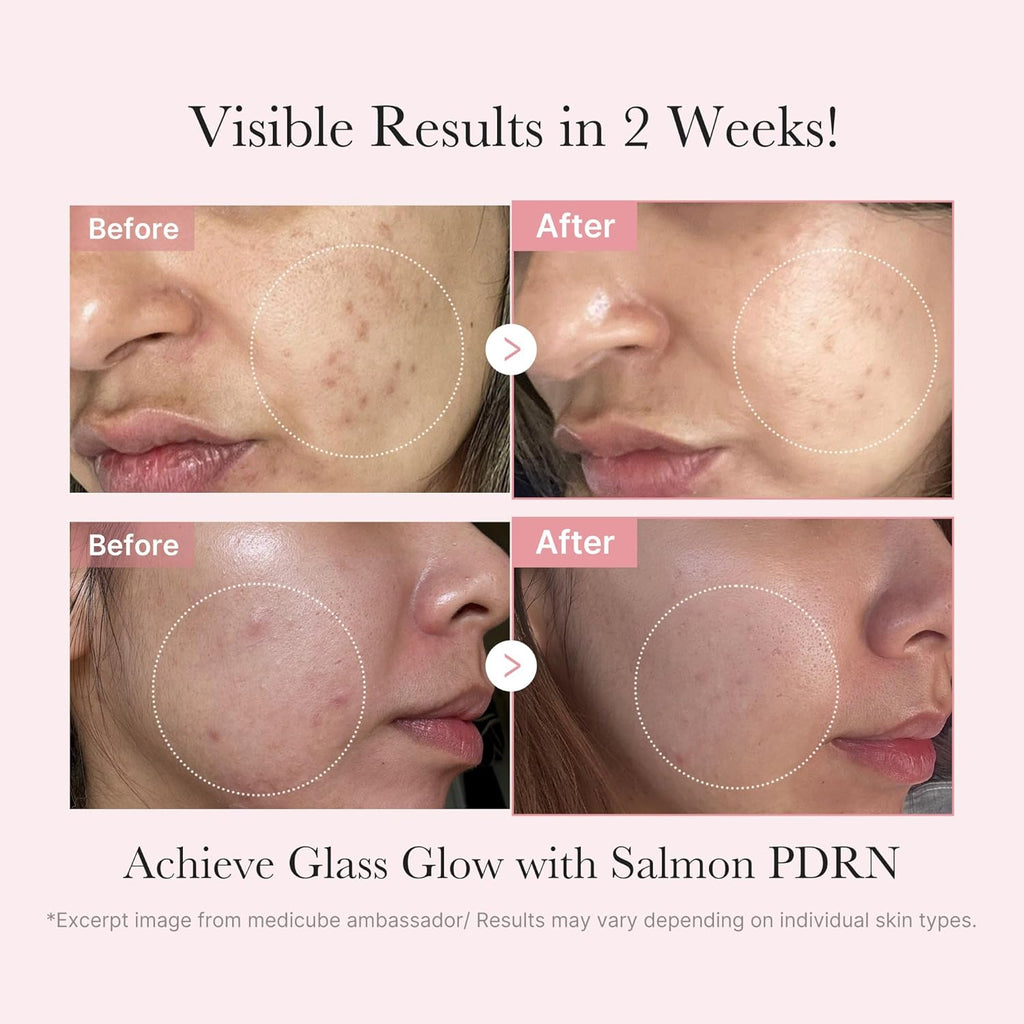 Glow Mini Salmon Kit