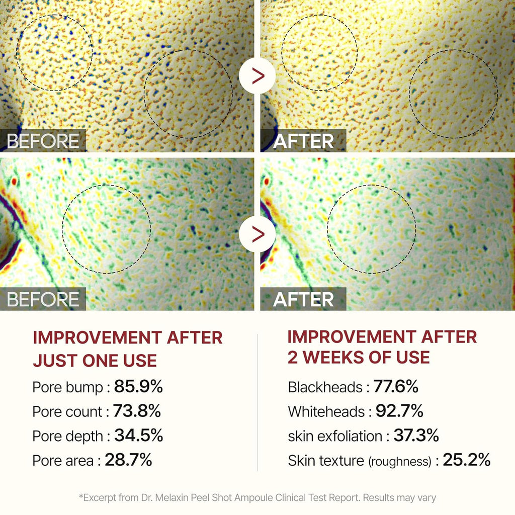 Radiant Rice Glow Peel Ampoule