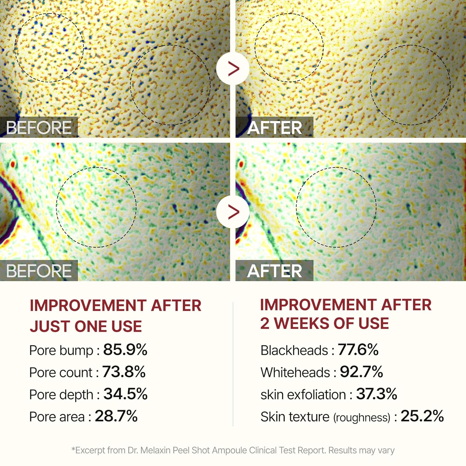 Radiant Rice Glow Peel Ampoule